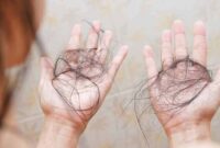 Ilustrasi Rambut Rontok | Foto: Ist.