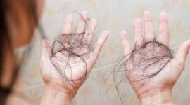 Ilustrasi Rambut Rontok | Foto: Ist.