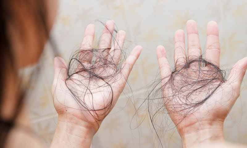 Ilustrasi Rambut Rontok | Foto: Ist.