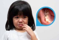 Ilustrasi Anak Sakit Gigi | Foto: Ist.