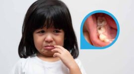 Ilustrasi Anak Sakit Gigi | Foto: Ist.