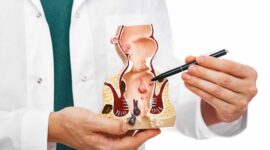 Ilustrasi | Foto: Ist.