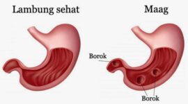 Ilustrasi | Foto: Ist.