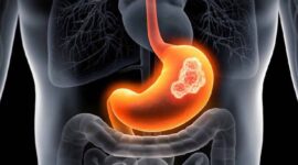 Ilustrasi | Foto: st.