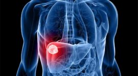 Ilustrasi | Foto: Ist.