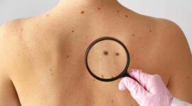 Ilustrasi | Foto: Ist.