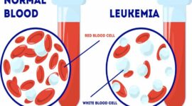 Ilustrasi | Foto: Ist.